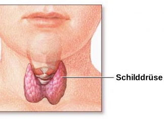 Ganzheitliche Therapie bei Hashimoto Schilddrüse