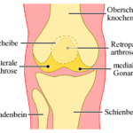 Arthrose und Knorpelregeneration