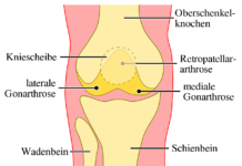 Arthrose und Knorpelregeneration
