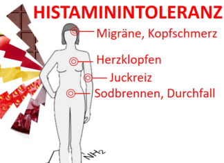 Histaminose: Ursache vieler Beschwerden