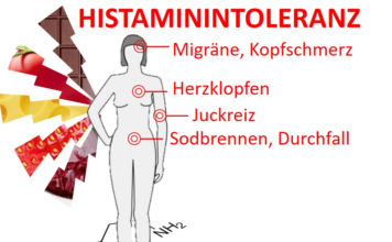 Histaminose: Ursache vieler Beschwerden